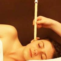Turning Point Acupuncture image 4